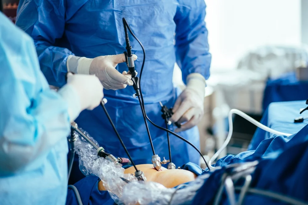 Laparoscopic Surgery